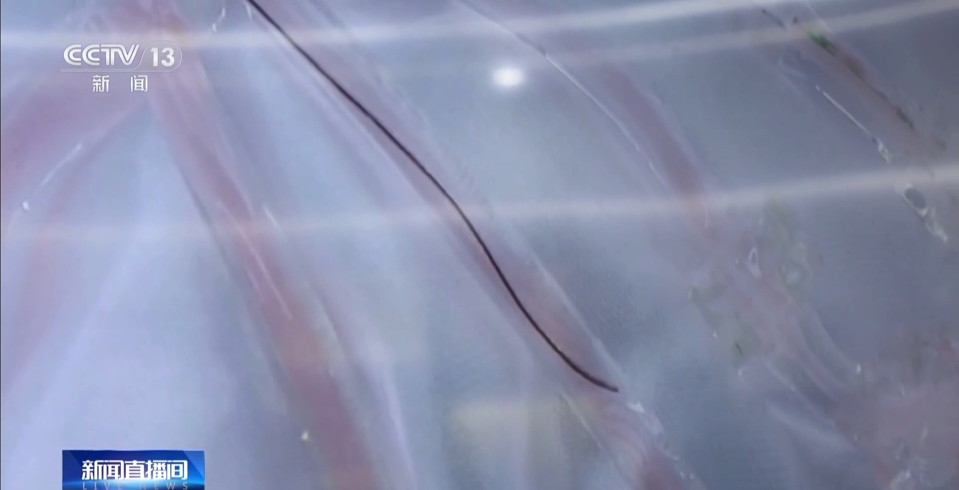 搭上AI“快车”后 深圳医疗效率达到了next level(图2)